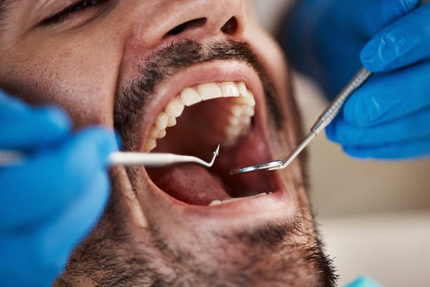 Best Urgent Care for Lost Fillings or Crowns in Clintondale, NY