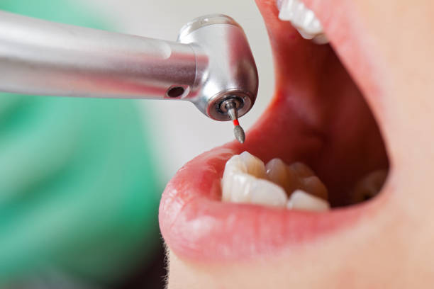 Best Emergency Gum Treatment in Clintondale, NY